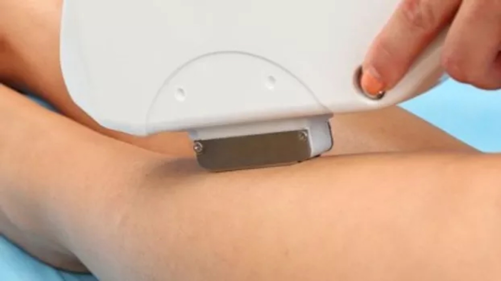 IPL hair reduction treatment at Dynamic Skin Services, Crawley