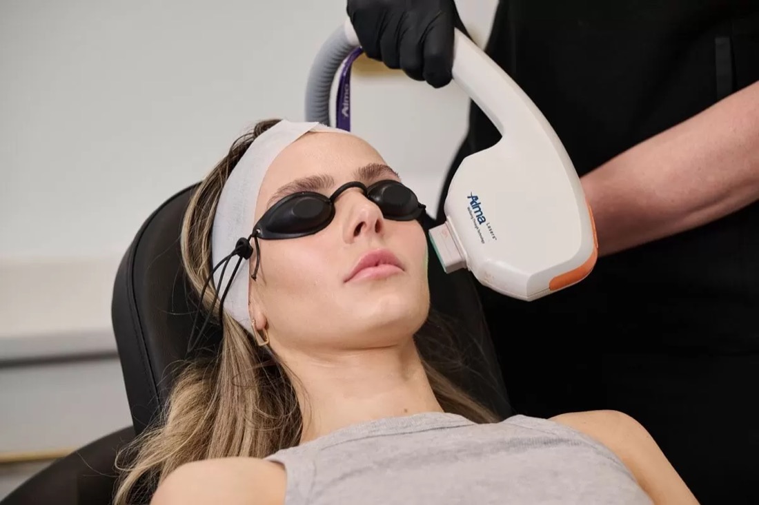 IPL photo rejuvenation skin treatment