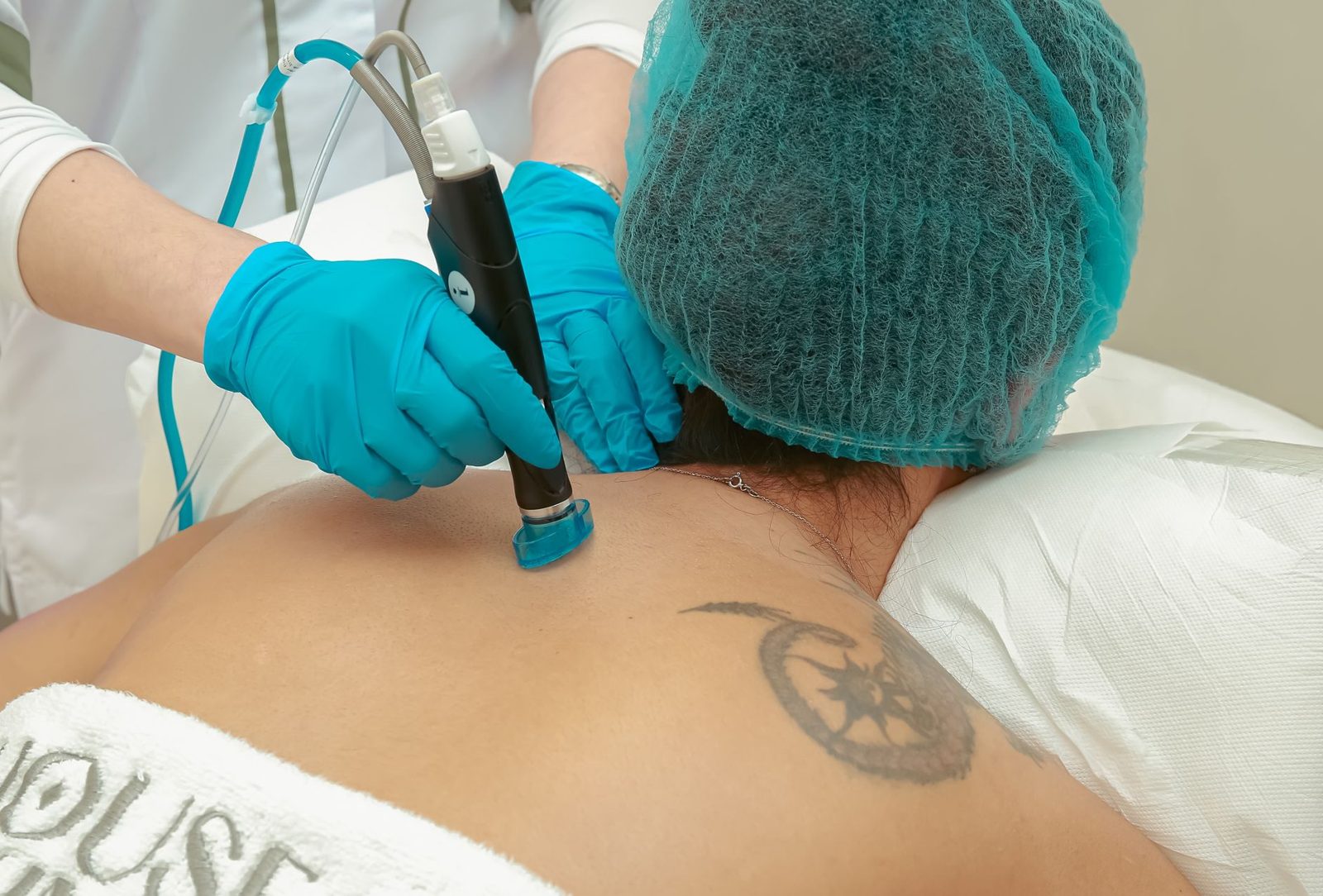 Unwanted tattoo before removal treatment