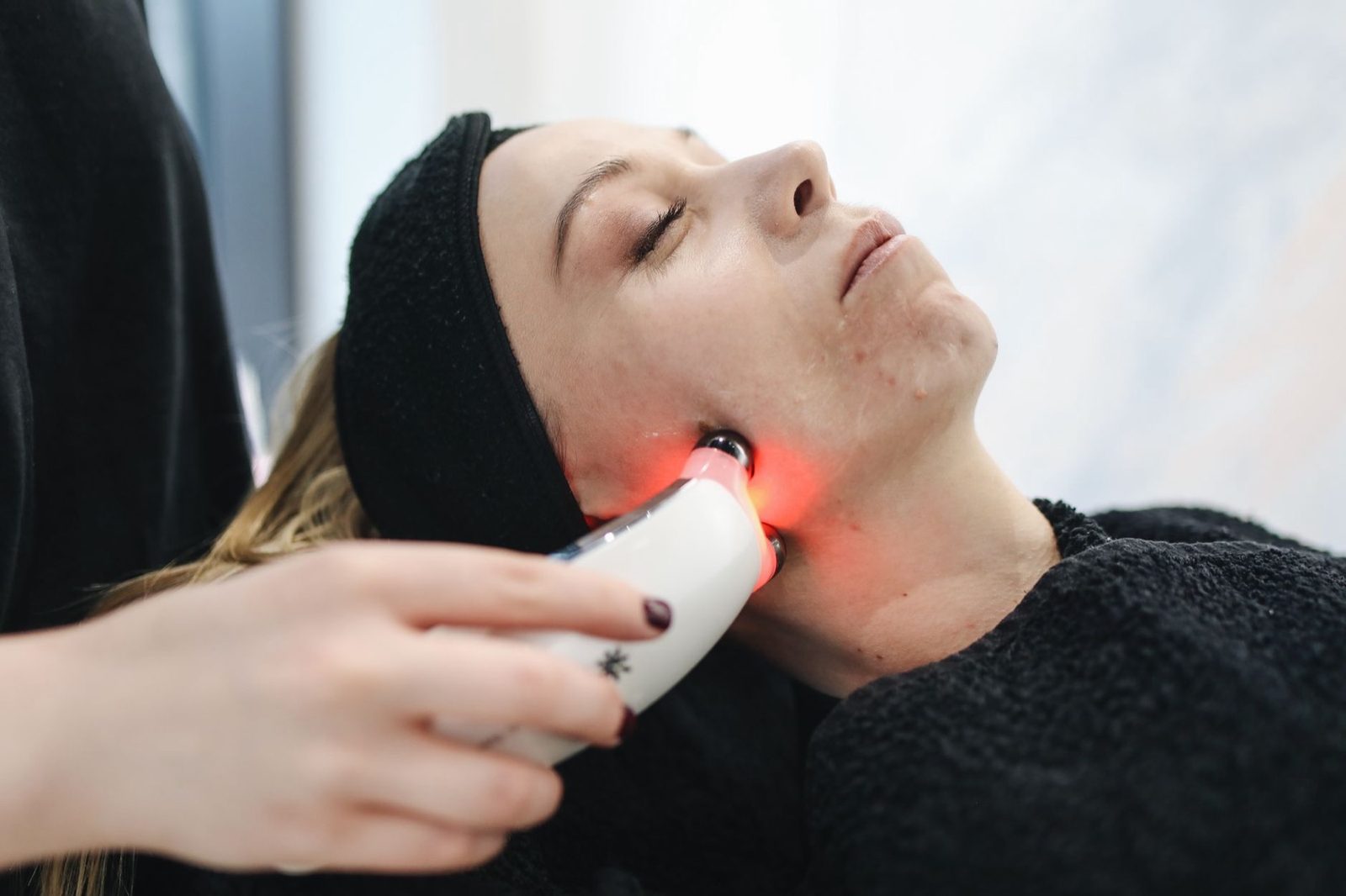 Radiofrequency skin tightening treatment