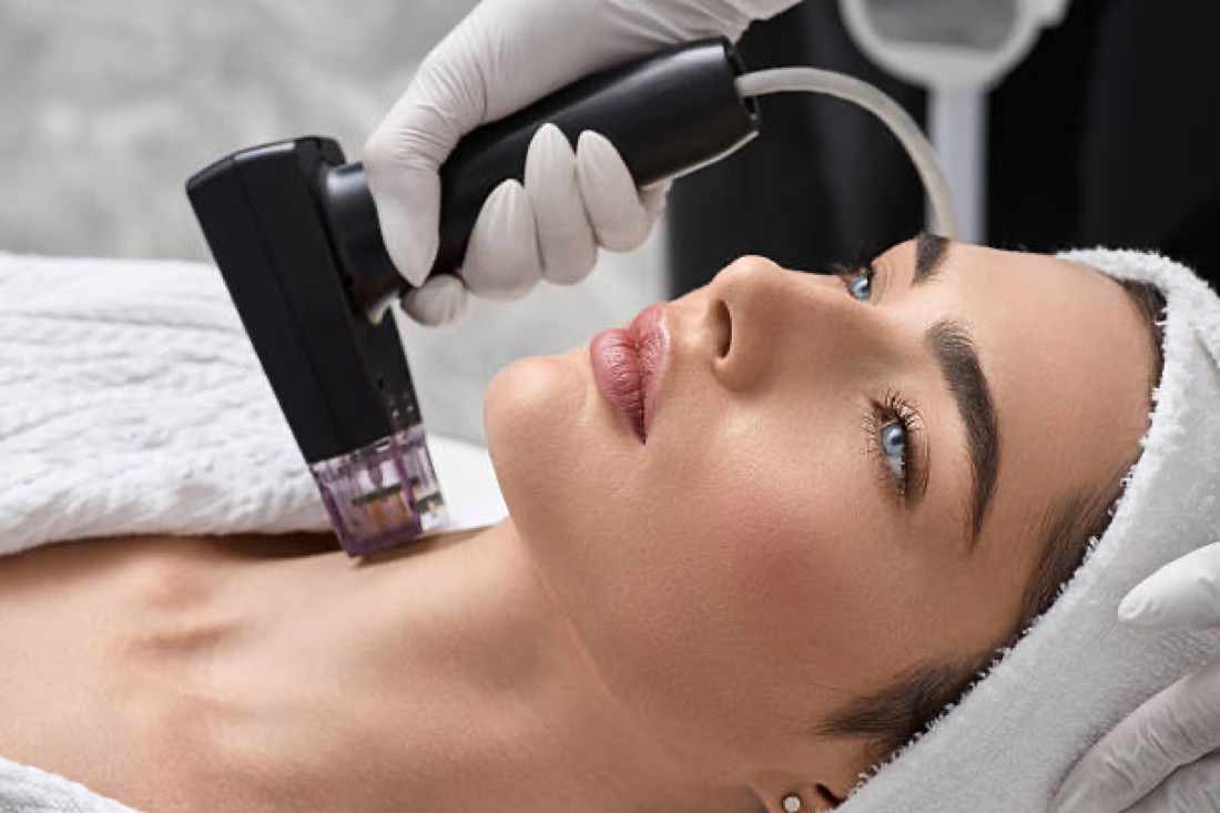 Skin needling and microdermabrasion treatment